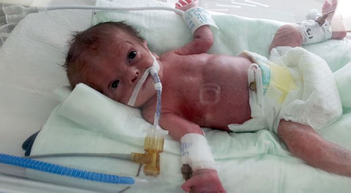 19 günlük ikizleri ölüm ayırdı 19 günlük ikizleri ölüm ayırdı