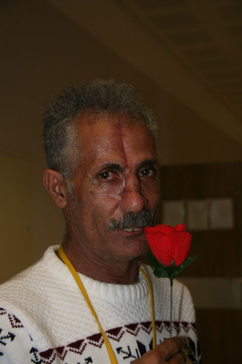 Kaburgasından burun yaptılar!