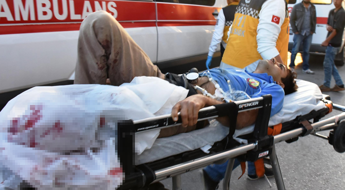 Buğday eleme makinesi ayağını kopardı
