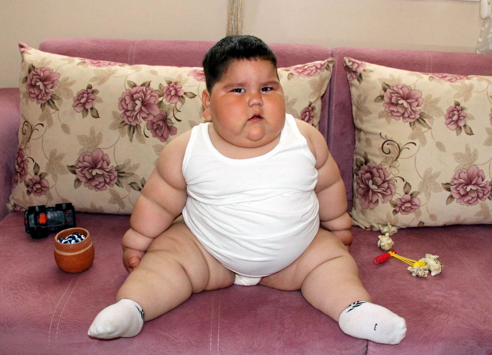 Görenler gözlerine inanamıyor! 1,5 yaşında 32 kilo...