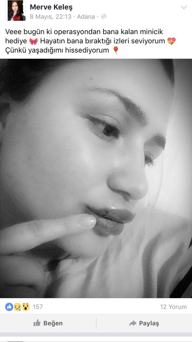 Silikon mağduru hemşireden haber var