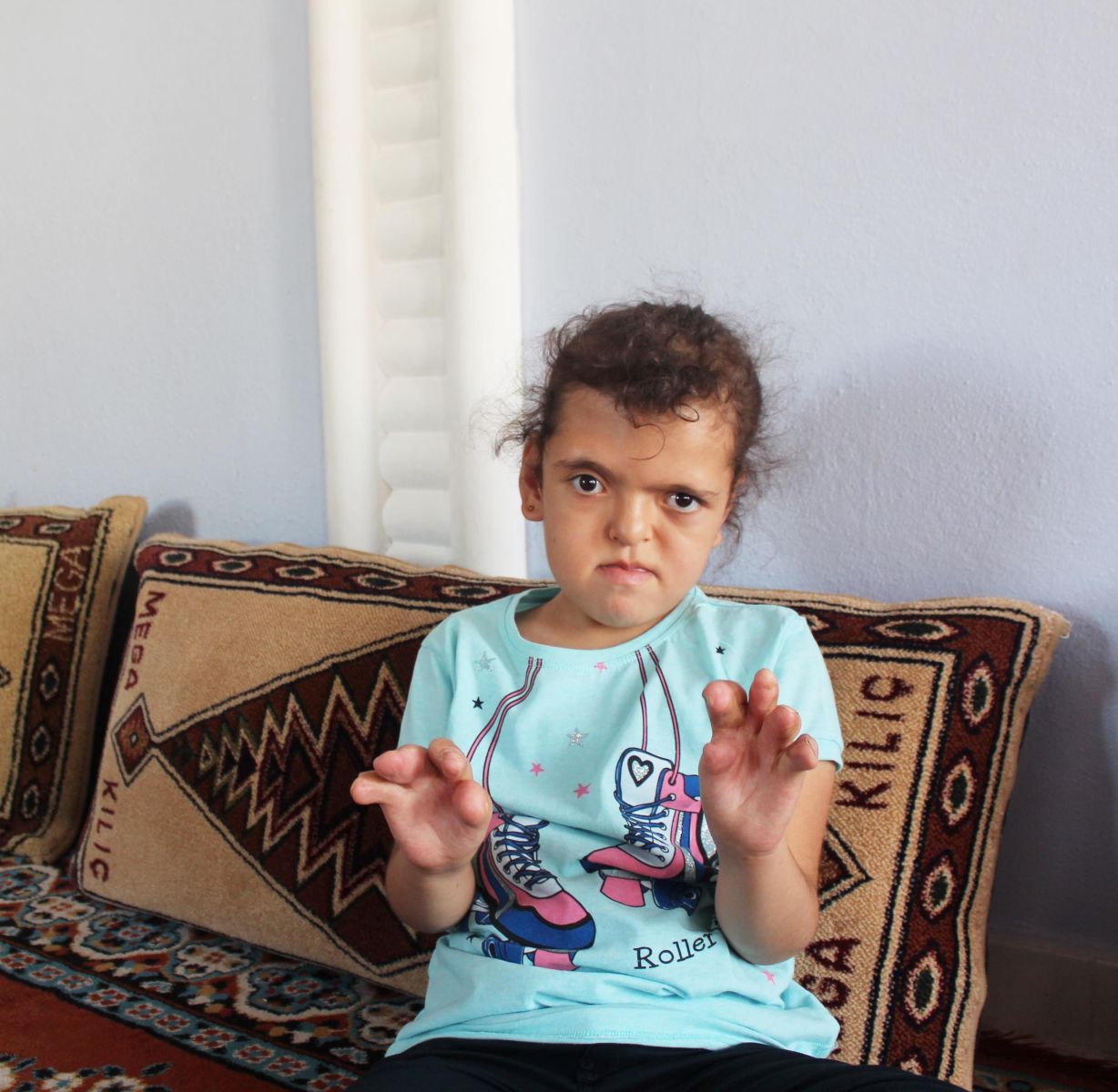 7 yaşındaki Özlem'in el ve ayak parmakları doğuştan yapışık