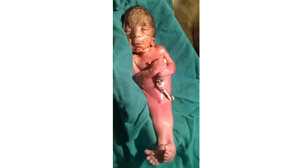 Deniz kızına benzer bebek doğdu!