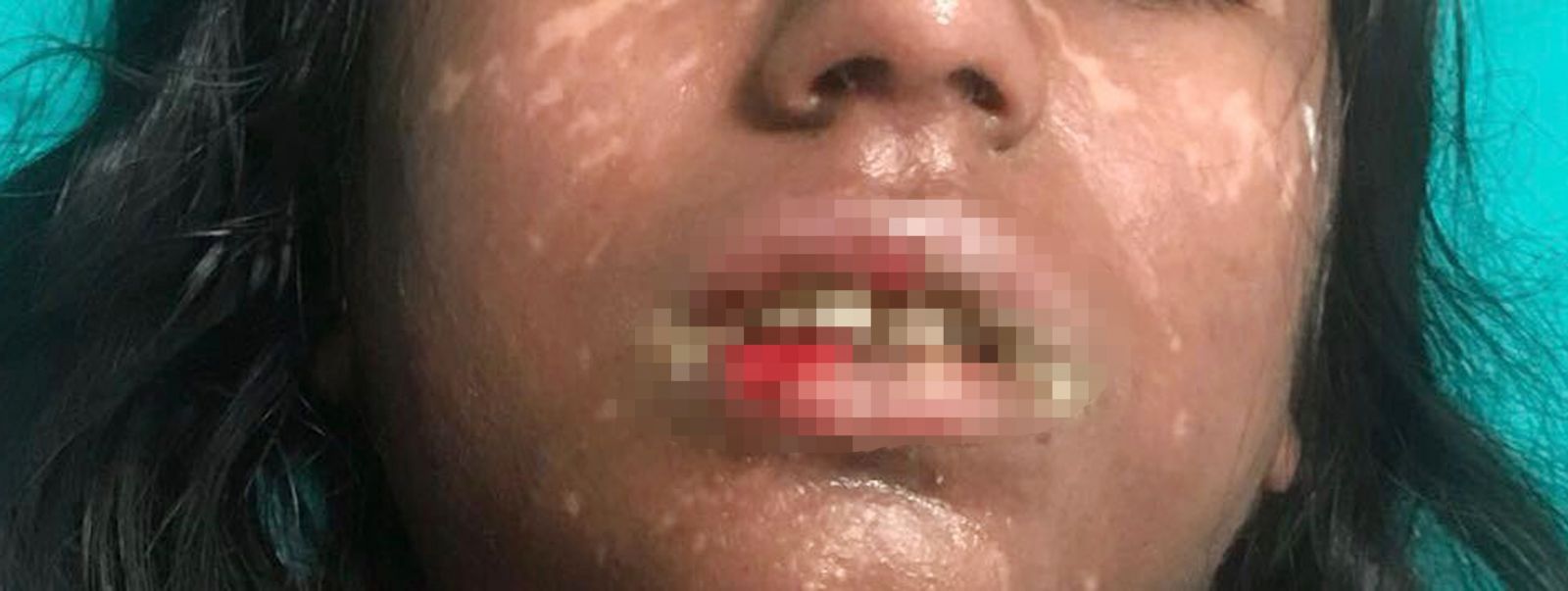 Sınav kaygısı için doktora gitti, bu hâle geldi!