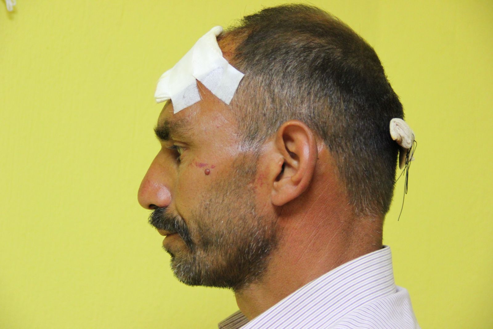 Selam vermedi diye bu hale getirdiler