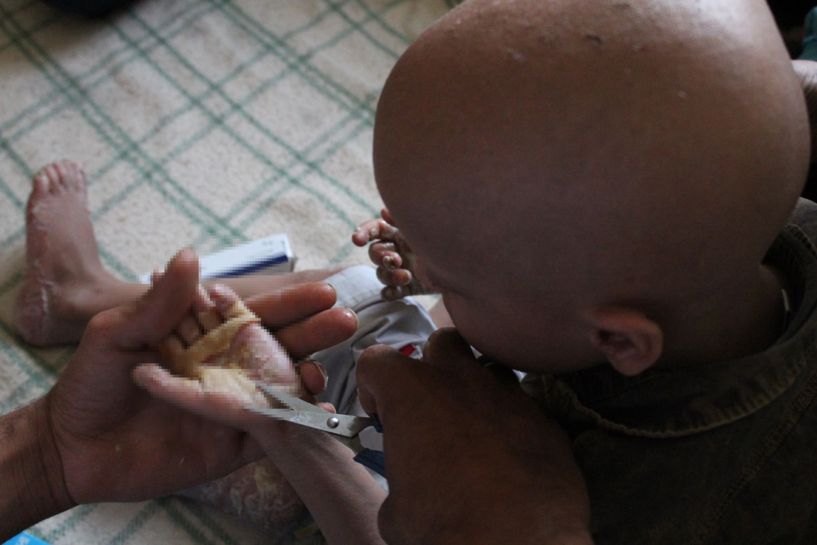 Bu çocuğun vücudundan doğuştan gözenek yok