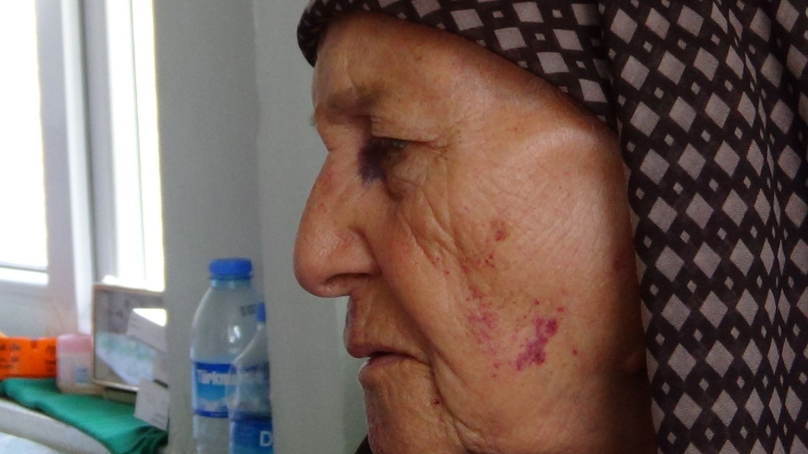 86 yaşındaki babaannesini döverek bileziklerini çaldı