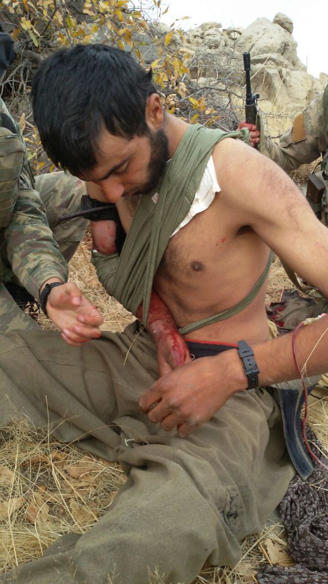 Mehmetçik'ten yaralı teröriste yardım eli