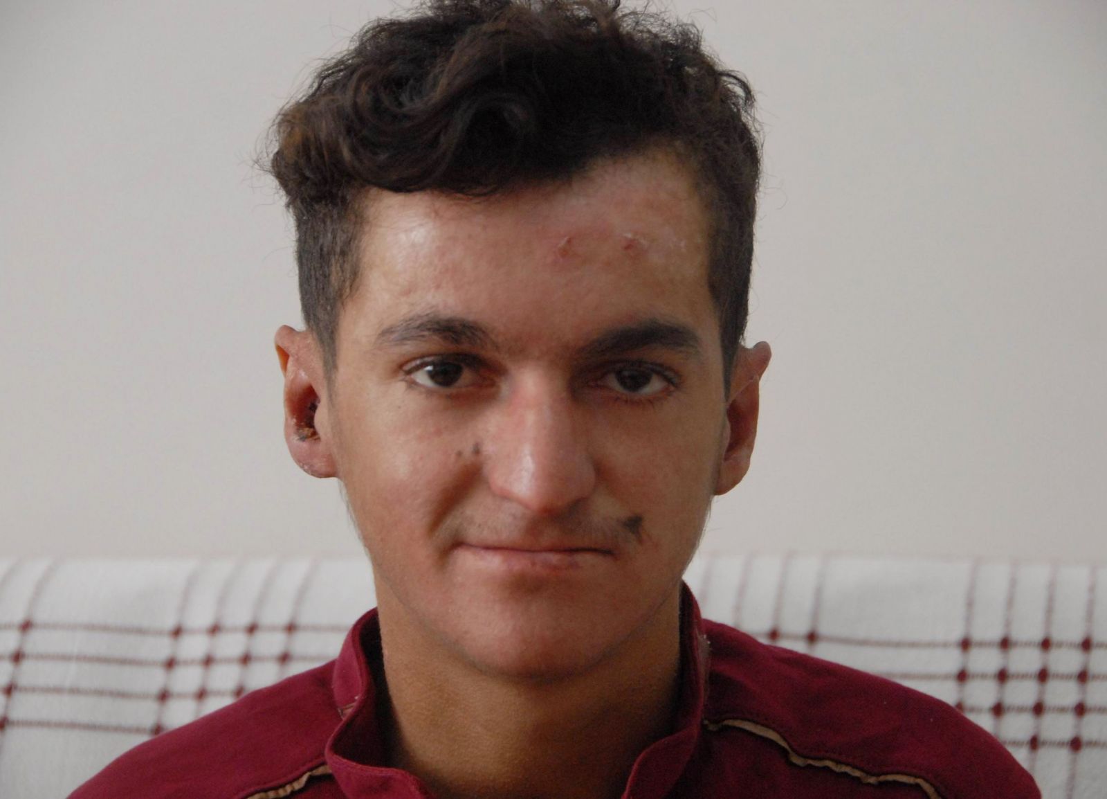 Kelebek hastası gencin en büyük hayali okumak