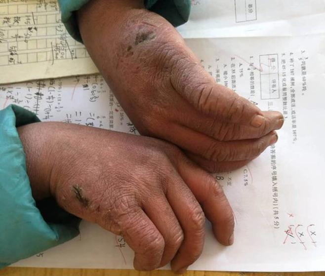 Çin'de bir öğrencinin elleri dondu, saçları buz tuttu