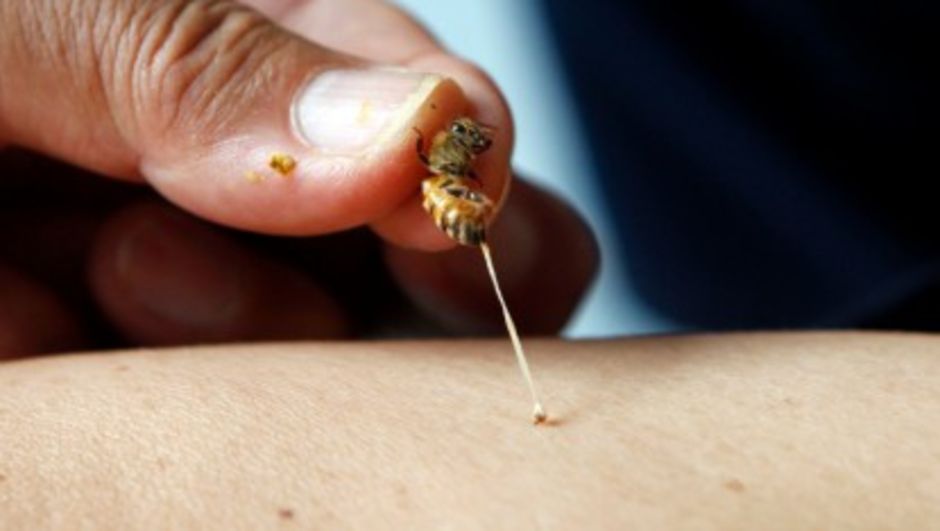 "Arı zehri birçok hastalığa iyi geliyor" "Arı zehri birçok hastalığa iyi geliyor"