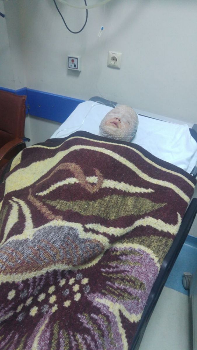 İnternette gördüklerini denemek istediler, felaketi yaşadılar!