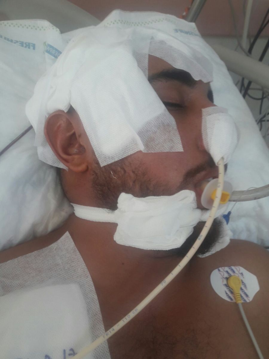 Üniversiteye kayıt yaptırdıktan 2 gün sonra bu hâle geldi!