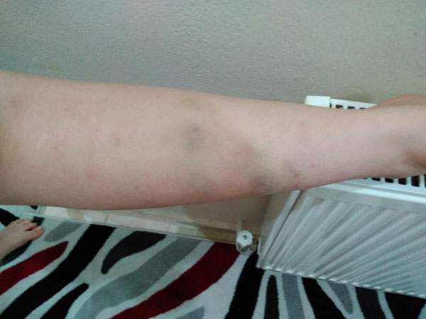 Facebook'tan bu fotoğrafları paylaşıp intihar etti!