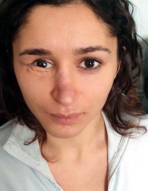 Genç kadın dehşeti yaşadı