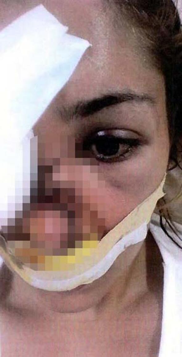 Genç kadın dehşeti yaşadı