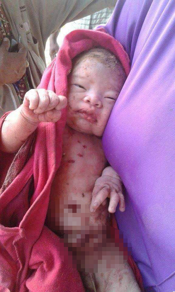 14 yerinden bıçaklanıp ormana gömülen bebek sağ kurtuldu