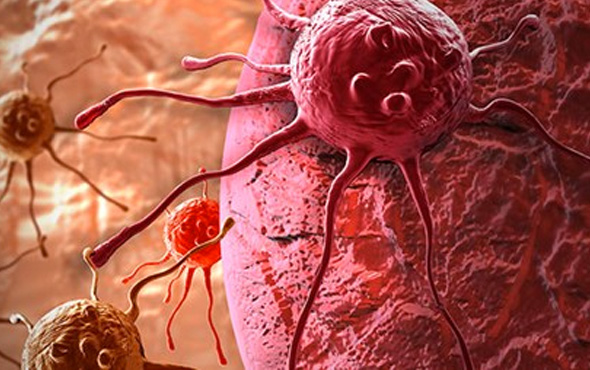 Kanser tedavisi nasıl uygulanır, kanser ağrıları nasıl geçer?