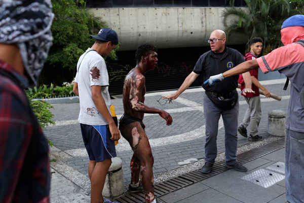 Venezuela'da bir gösterici diri diri yandı