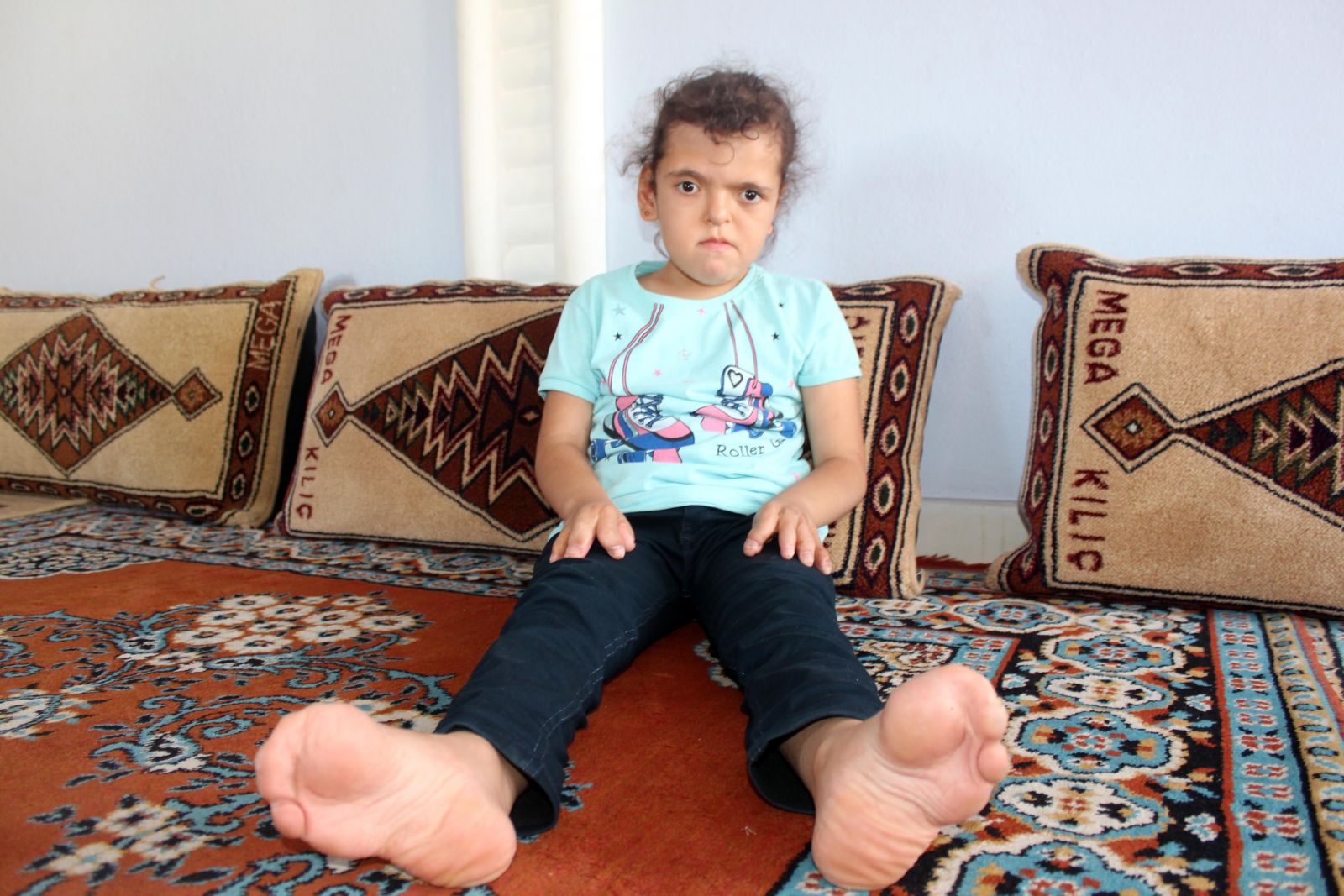 7 yaşındaki Özlem'in el ve ayak parmakları doğuştan yapışık