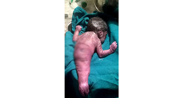 Deniz kızına benzer bebek doğdu!