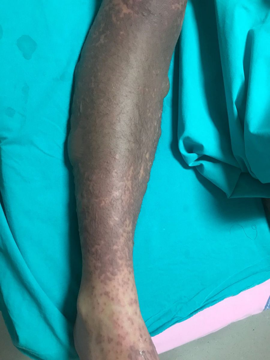 Sınav kaygısı için doktora gitti, bu hâle geldi!