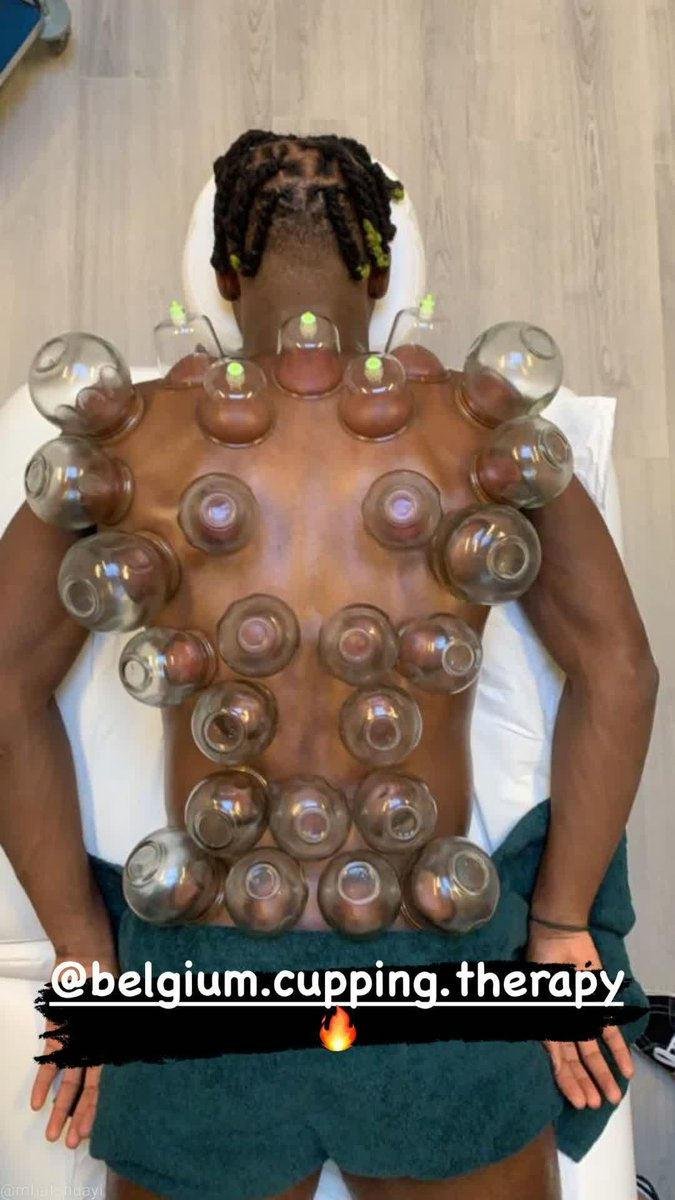 Michy Batshuayi’den hacamat keyfi! Sosyal medyada gündem oldu