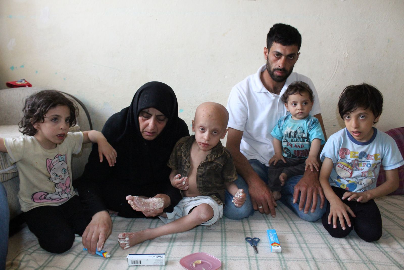 Bu çocuğun vücudundan doğuştan gözenek yok