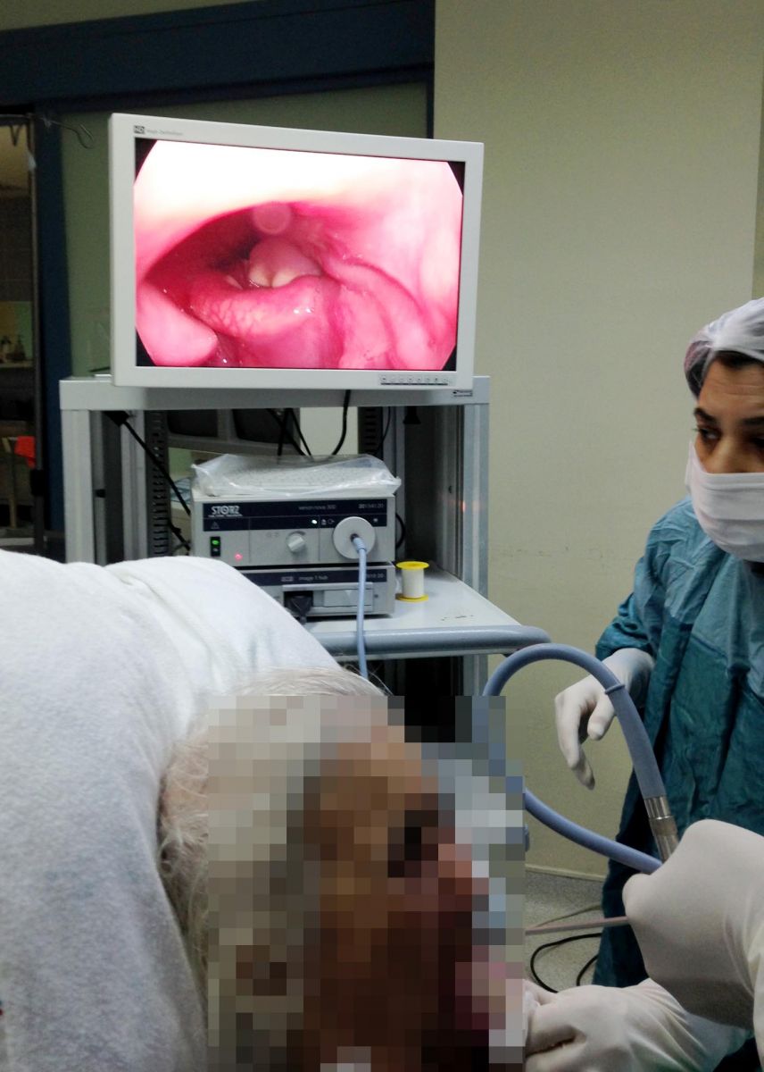 Uyurken boğazına diş protezi kaçtı