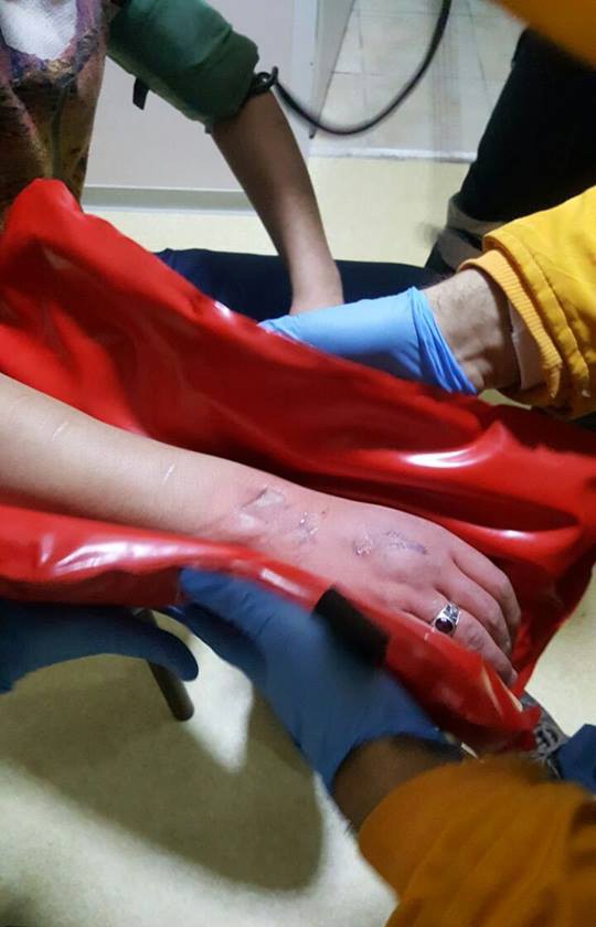 Eli asansöre sıkışan genci itfaiye kurtardı