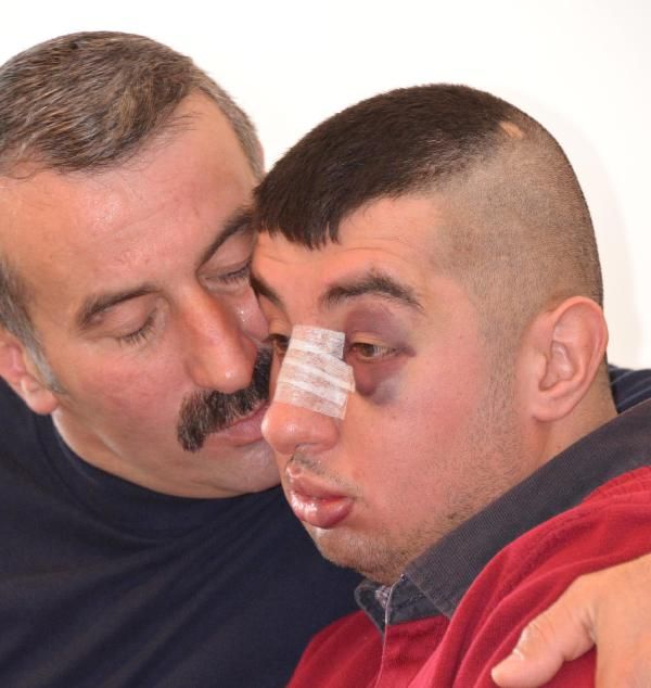 Zihinsel engelli gence dayak!