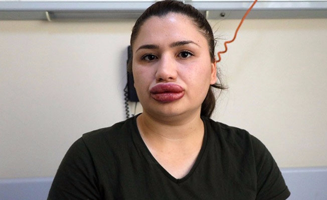 Sahte estetikçinin cezası belli oldu