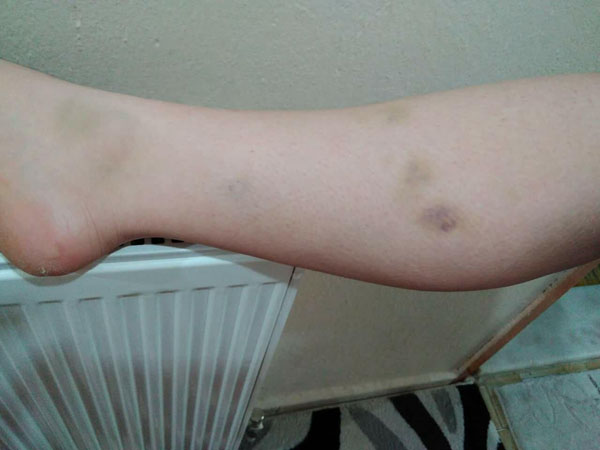 Facebook'tan bu fotoğrafları paylaşıp intihar etti!