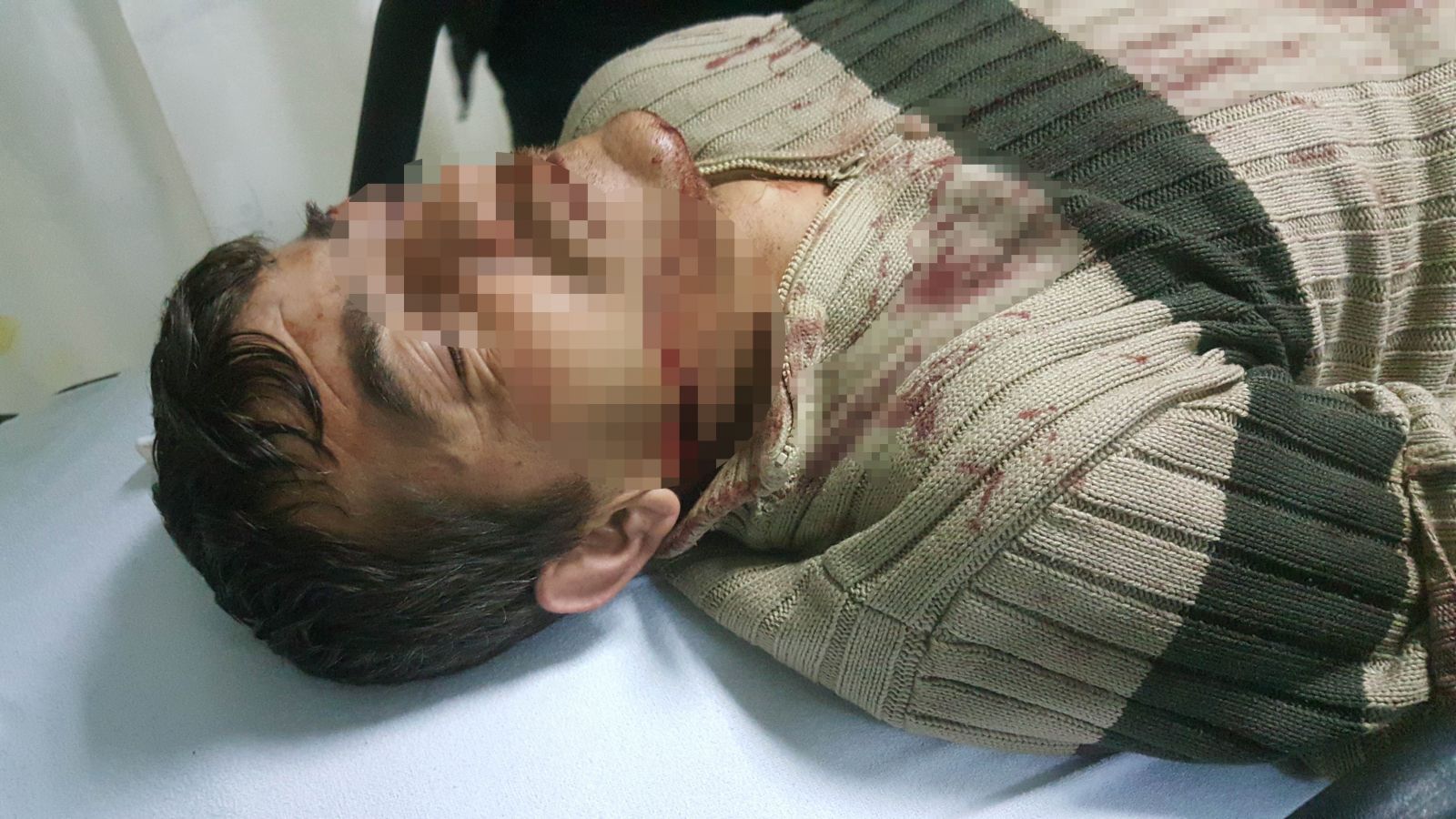 Samsun'da eski koca dehşeti, 2 kişi yaralandı