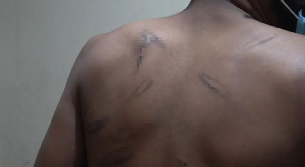 Yunan askerlerinin işkence ettiği Pakistanlı göçmenler Türk askerlerinin yardımıyla kurtuldu