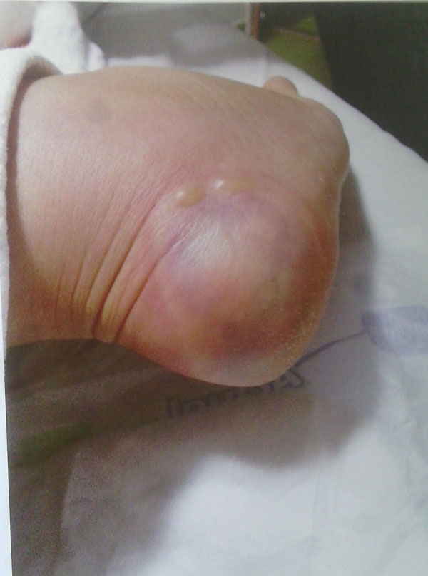 Hemşire doğumdan çıkan kadının ayaklarını yaktı!