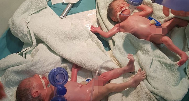 Kayserili çiftin dördüz bebek şaşkınlığı!