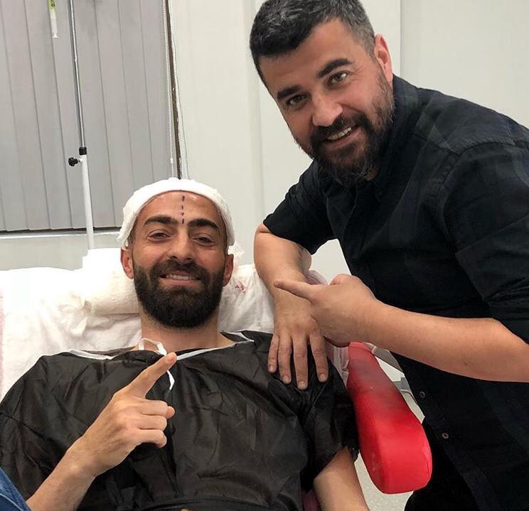 Saç ekim uzmanı Aydın: 