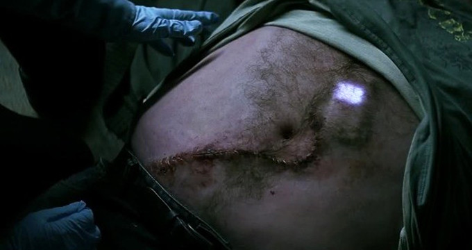 İnanılır gibi değil! Bu adam cep telefonunu yuttu