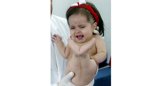 Deniz kızına benzer bebek doğdu!