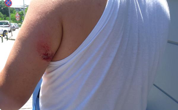 Kendisini yakalayan polisin kolunu ısırdı