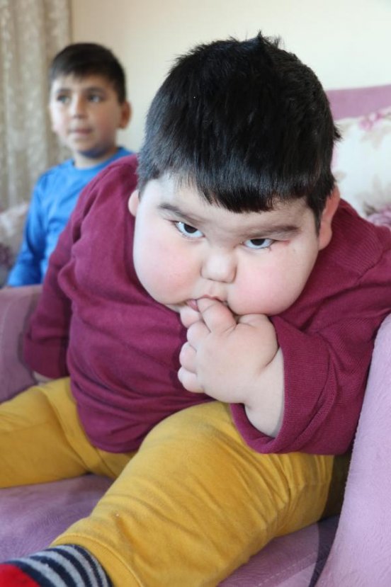 2 yaşında 29 kilo olan Yağız, Erdoğan'la buluştu