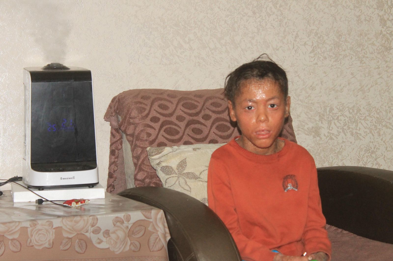 Küçük Melih sizlerin sayesinde iyileşiyor