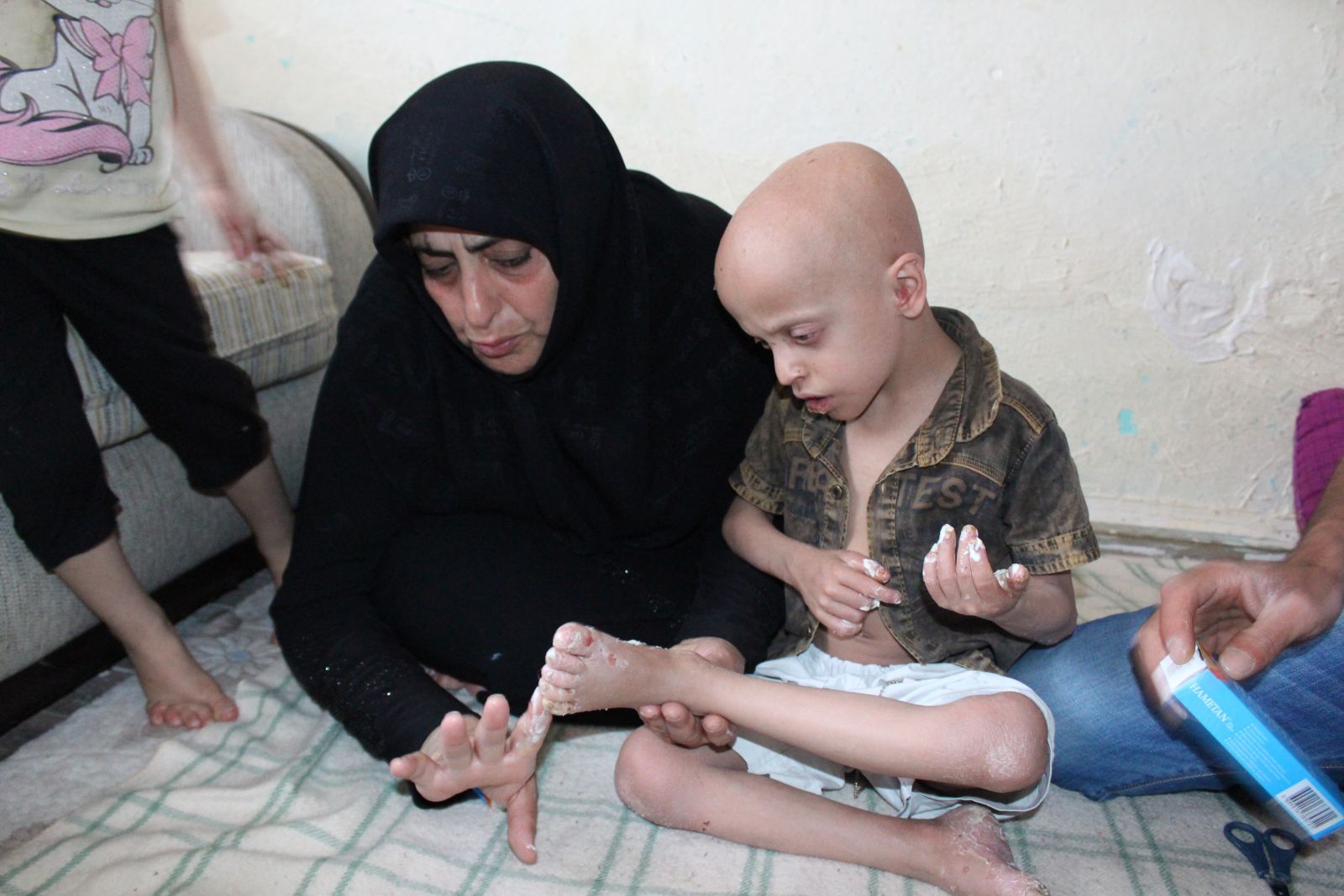 Bu çocuğun vücudundan doğuştan gözenek yok