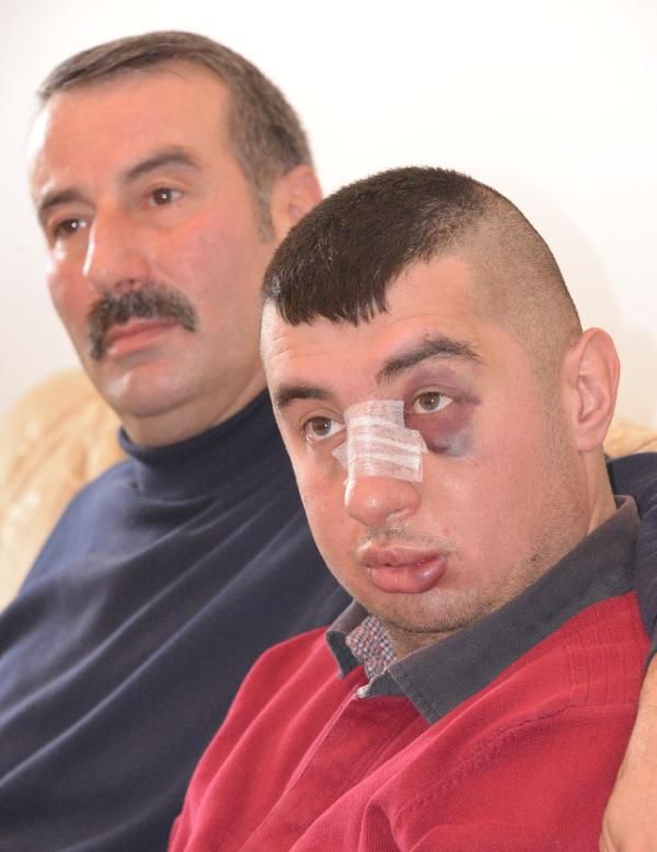 Zihinsel engelli gence dayak!