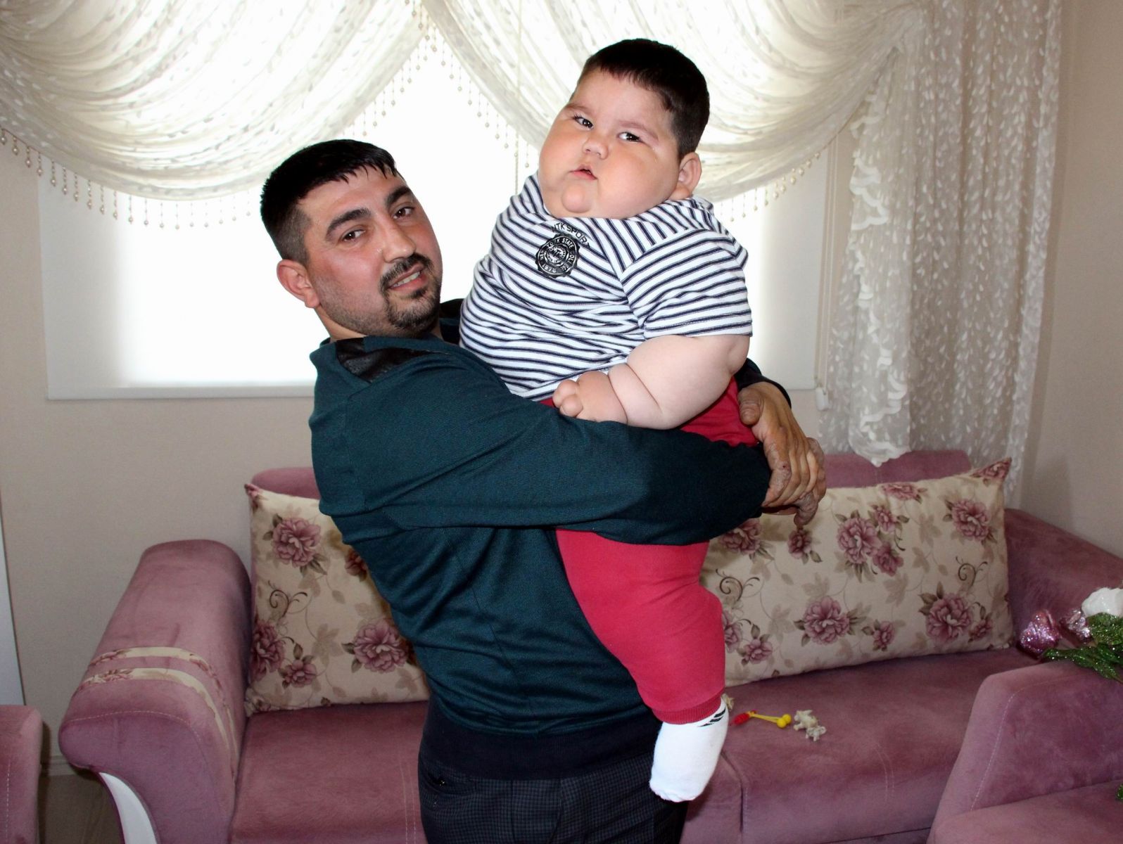 Görenler gözlerine inanamıyor! 1,5 yaşında 32 kilo...