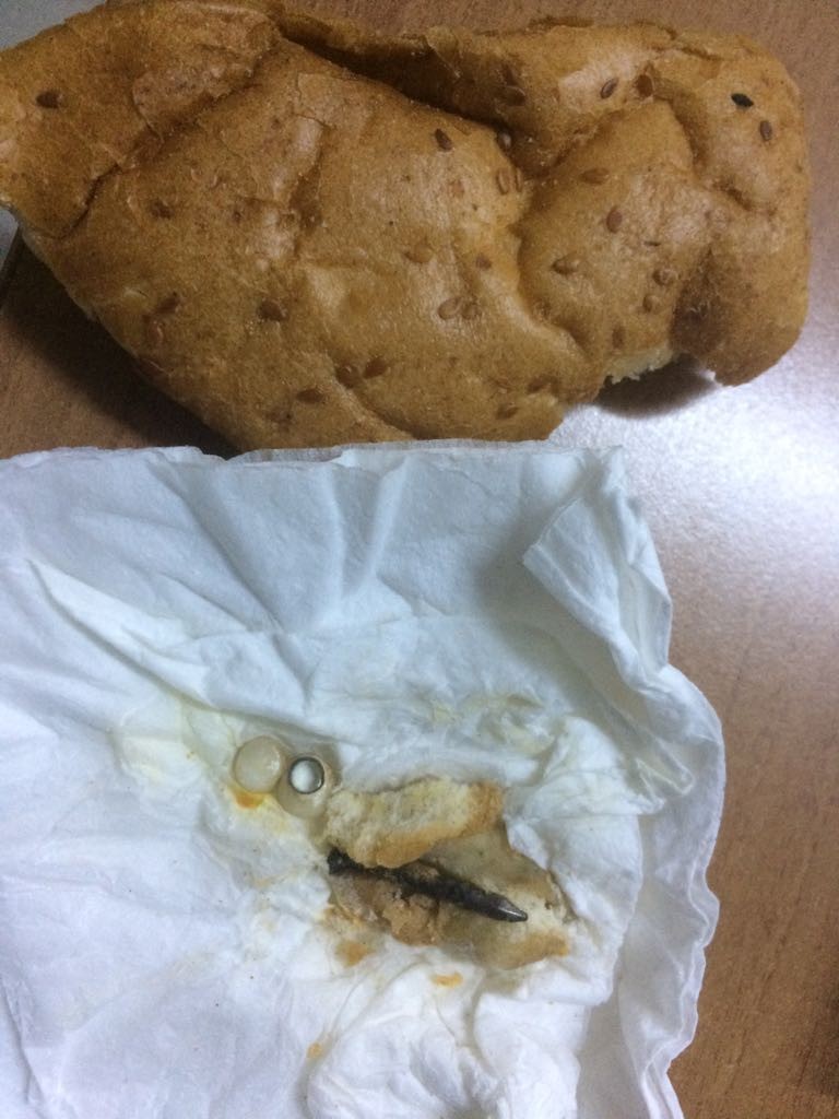 Pidenin içinden çıkan 3,5 cm'lik çivi 4 dişini kırdı