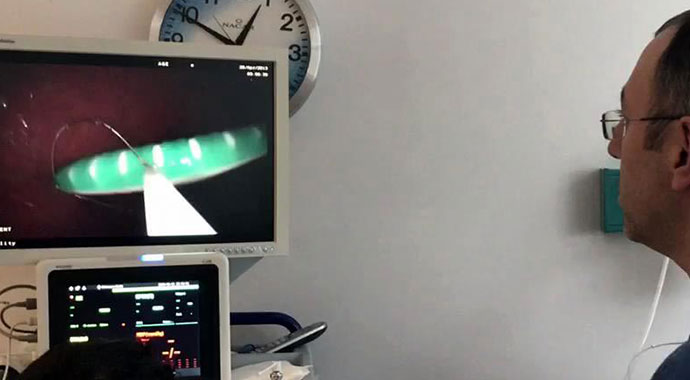 Akılalmaz olay... Kusmak için boğazına soktuğu diş fırçasını yuttu