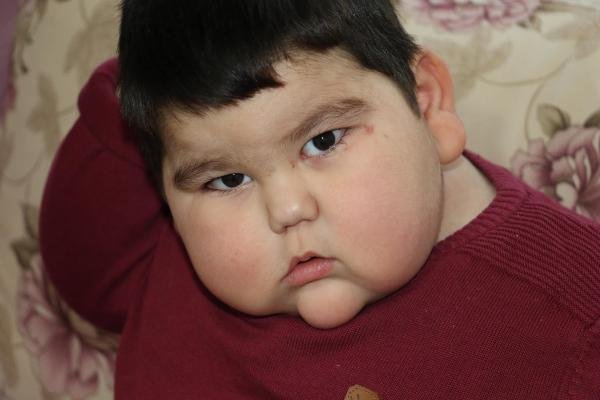 2 yaşında 29 kilo olan Yağız, Erdoğan'la buluştu