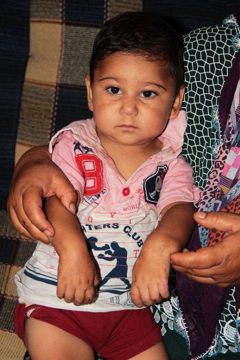 Isırarak kendine zarar veren bebeğin ailesi yardım istiyor